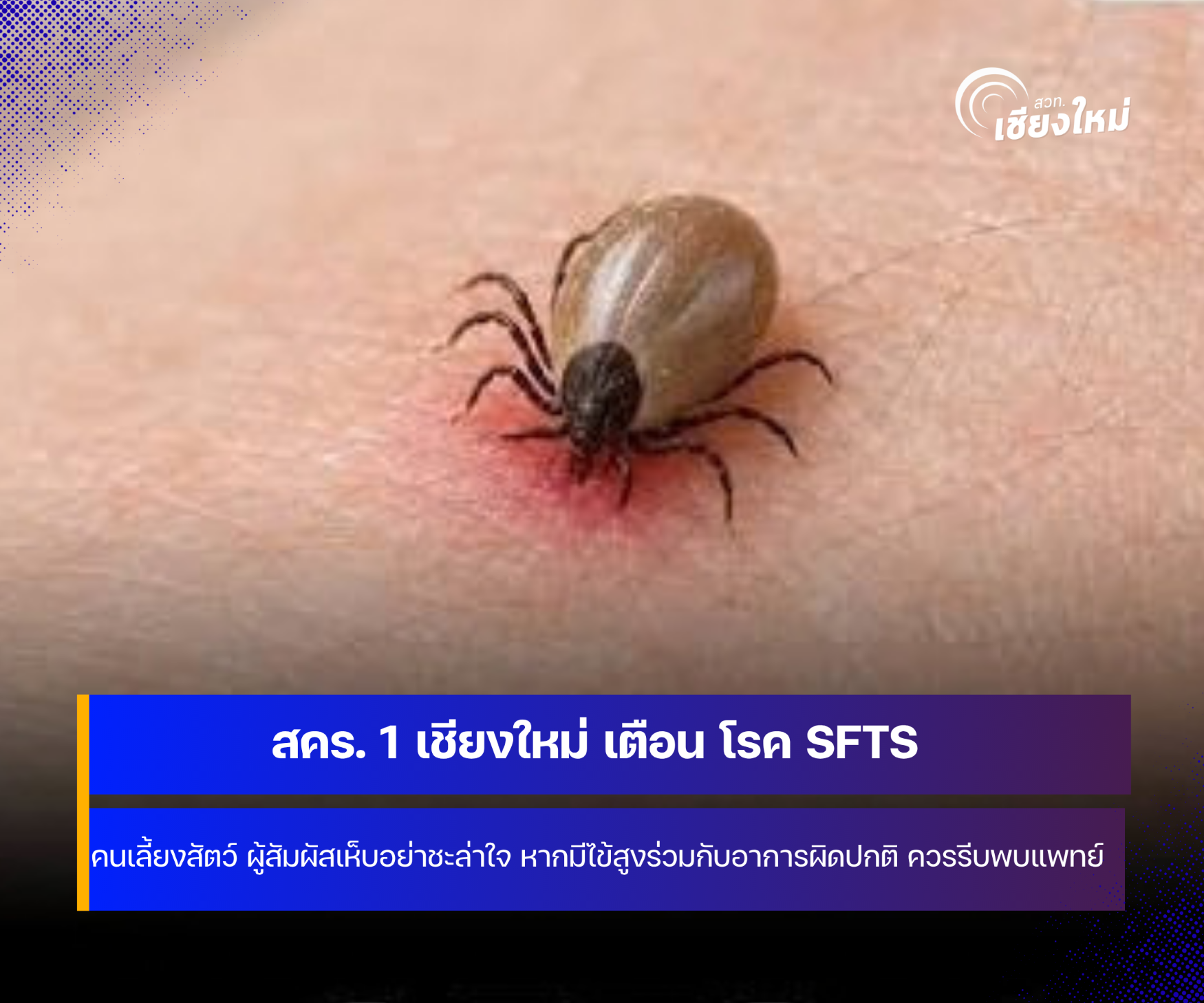 สคร. 1 เชียงใหม่ เตือน โรคไข้สูงเกล็ดเลือดต่ำจากเห็บ 